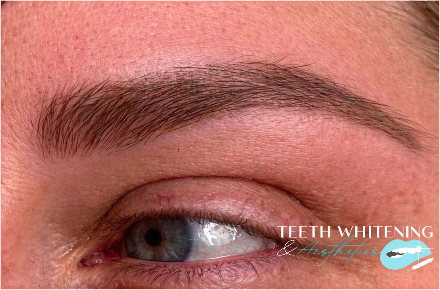 Microblading