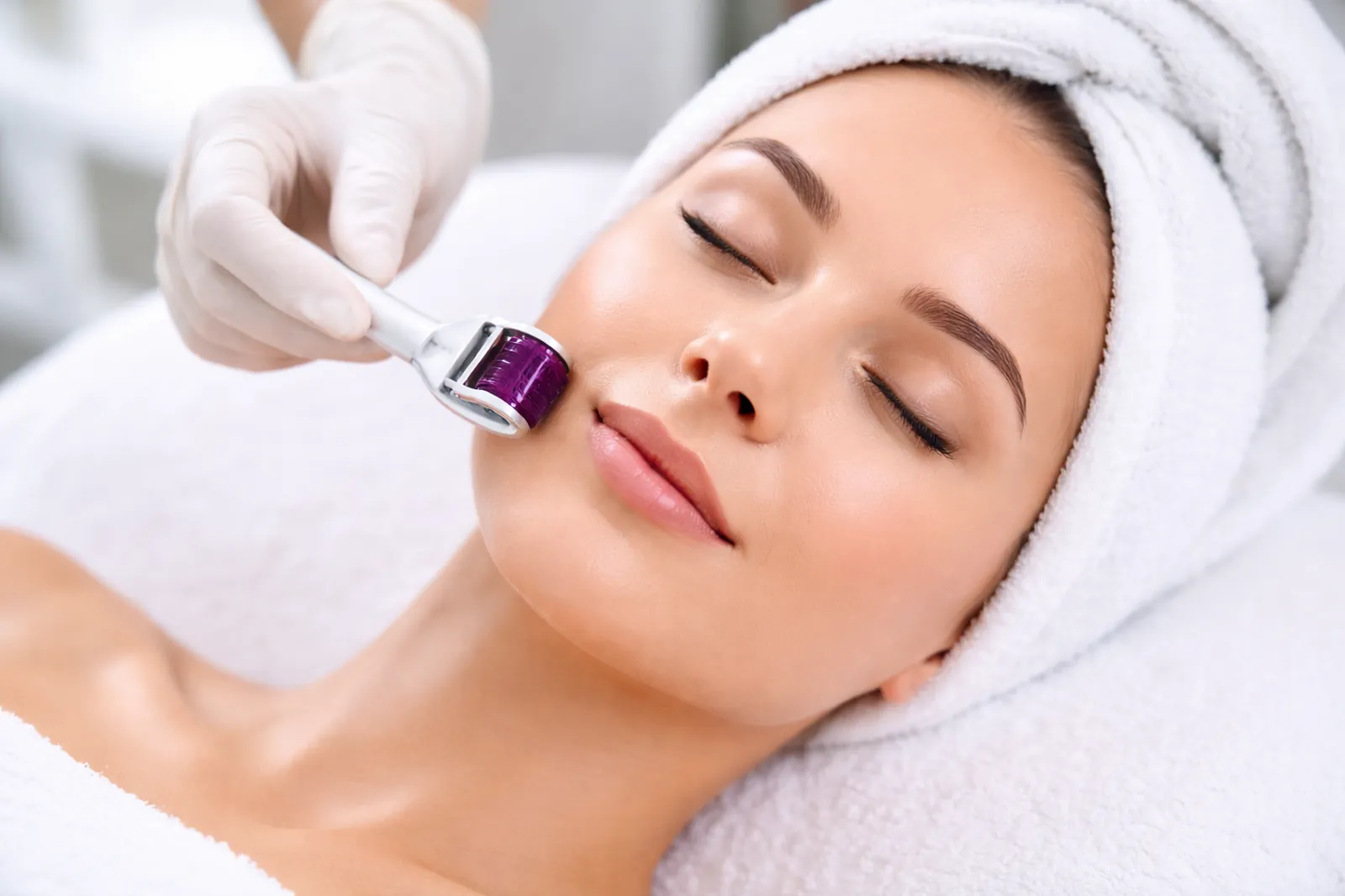 Microneedling
